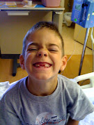 Missing my 2 Front Teeth