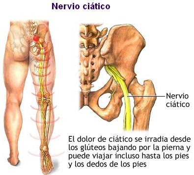 El lactante la lesión sheynogo del departamento de la columna vertebral