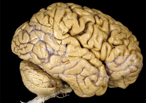 [human-brain-vis304784-ga.jpg]