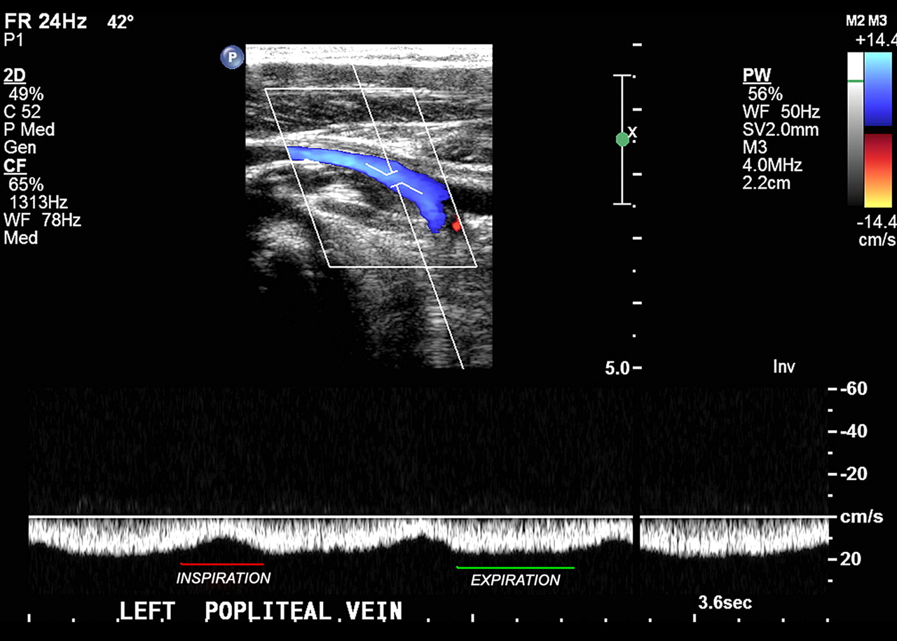 RadiologySpirit 20100704