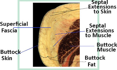 superficial fascial system of the buttock
