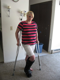 Bowman Family: My Broken Leg!