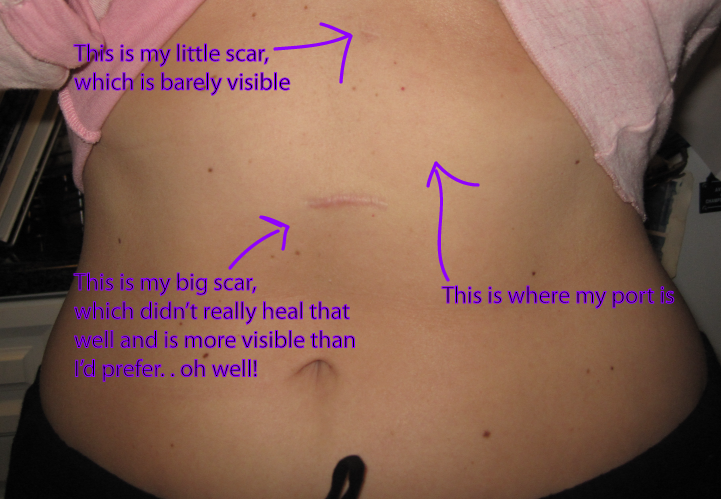 [Feb2010Scar.png]