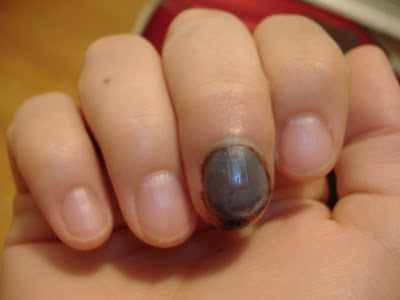 nail hole finger under spot red riddle trunk silvery pinned entire end had night where color