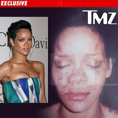 Rihanna Pictures After Beating