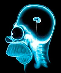 Radiographie du cerveau d'Omer Simpson...