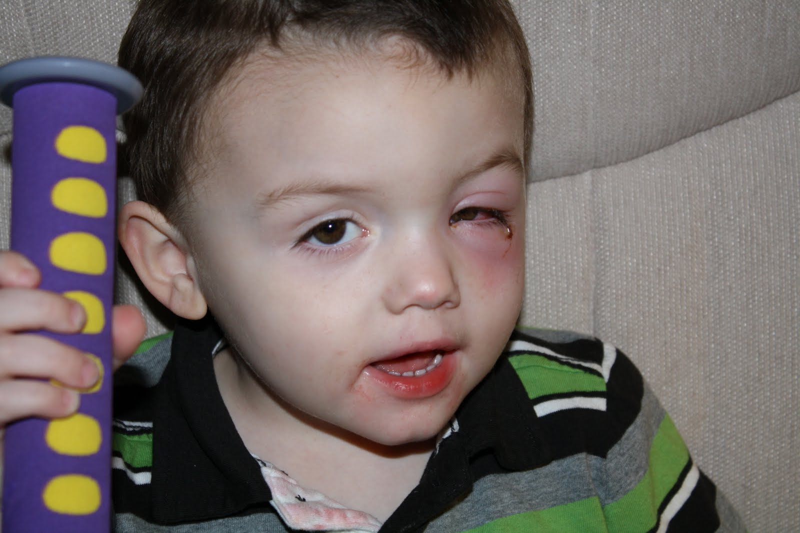 The Simply Made What cures pink eye?