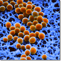 Científicas Argentinas luchan contra una “súper” bacteria