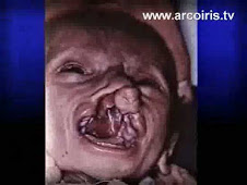 bagdad: bambino nato dopo bombardamenti  uranio