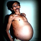 Οι 10 πιο παράξενοι άνθρωποι του κόσμου