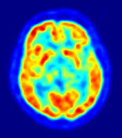 cervello in attività durante una PET
