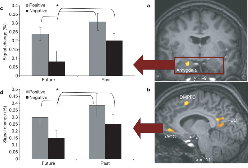 [optimistic_amygdala.jpg]