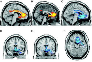[Fig4af_Johansen-Berg.gif]