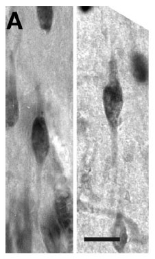 [elephant+spindle+neurons.jpg]