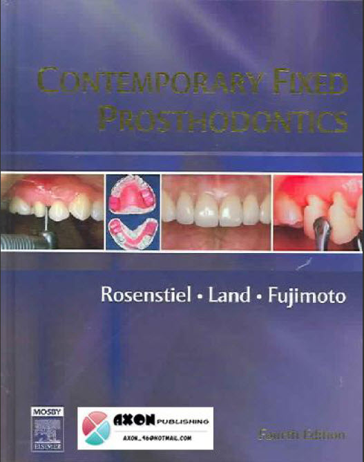Fixed prosthodontics picture