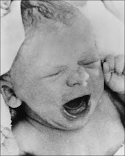 25th July '78 - World's 1st IVF Baby: