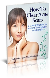Clear Acne Scars Guide