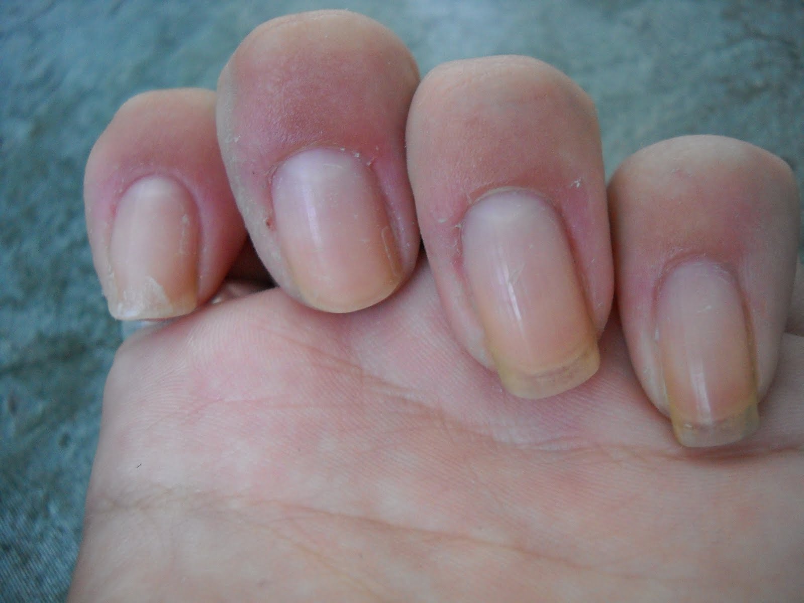 Miezziej's beauty polish blog Essence SOS Nail Repair Pads Part 2