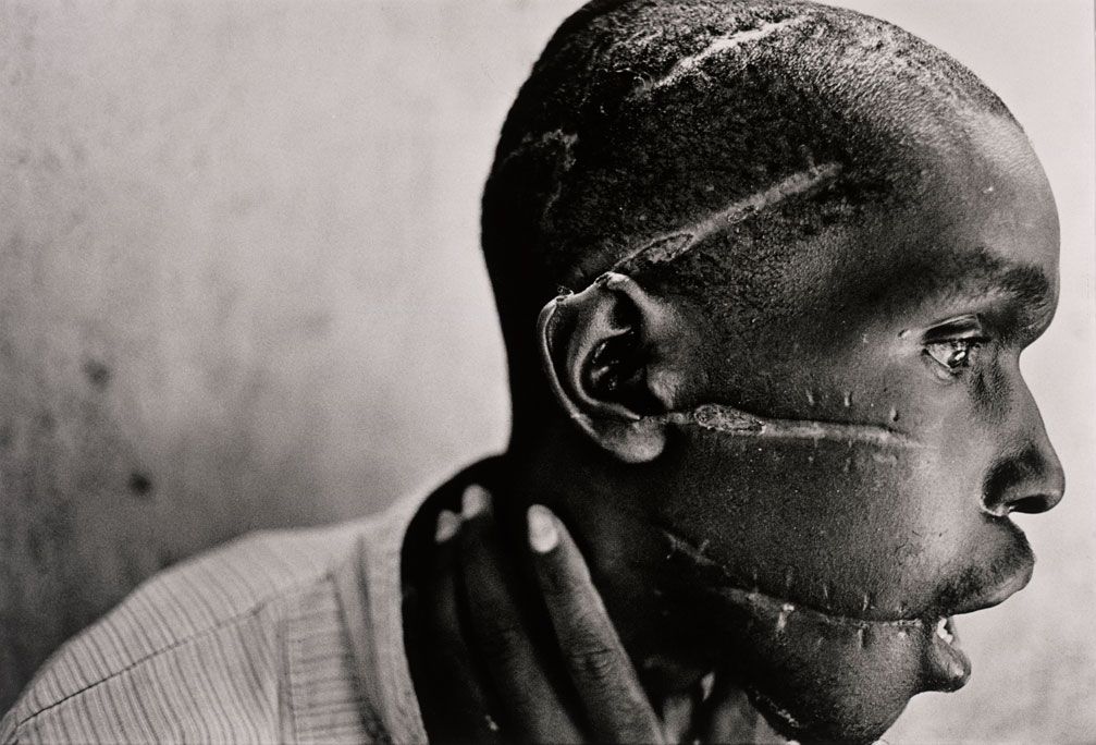 [hutu-man-mutilated-james+Nachtwey+1994.jpg]