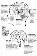 Early neurodevelopment: ASD & The human brain!