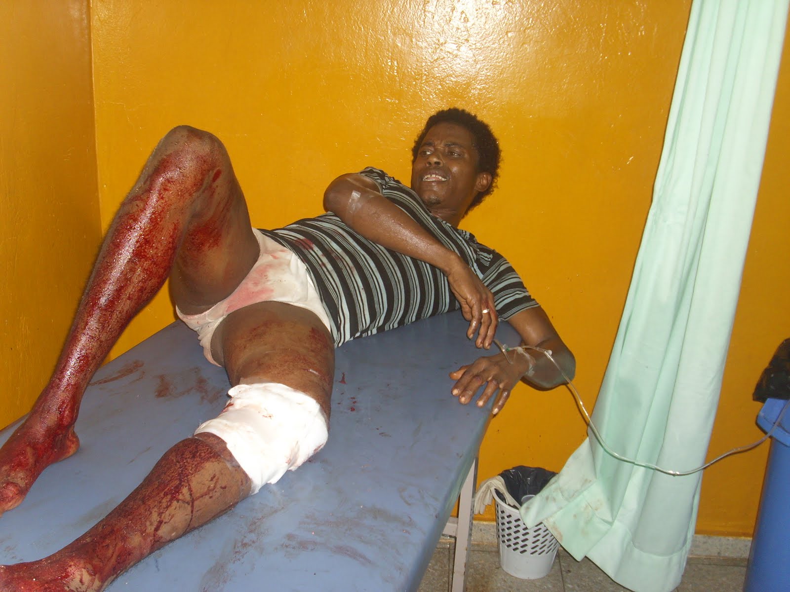 [6060.-joven_herido_de_bala_en_el_Muzlo_derecho[2].JPG]