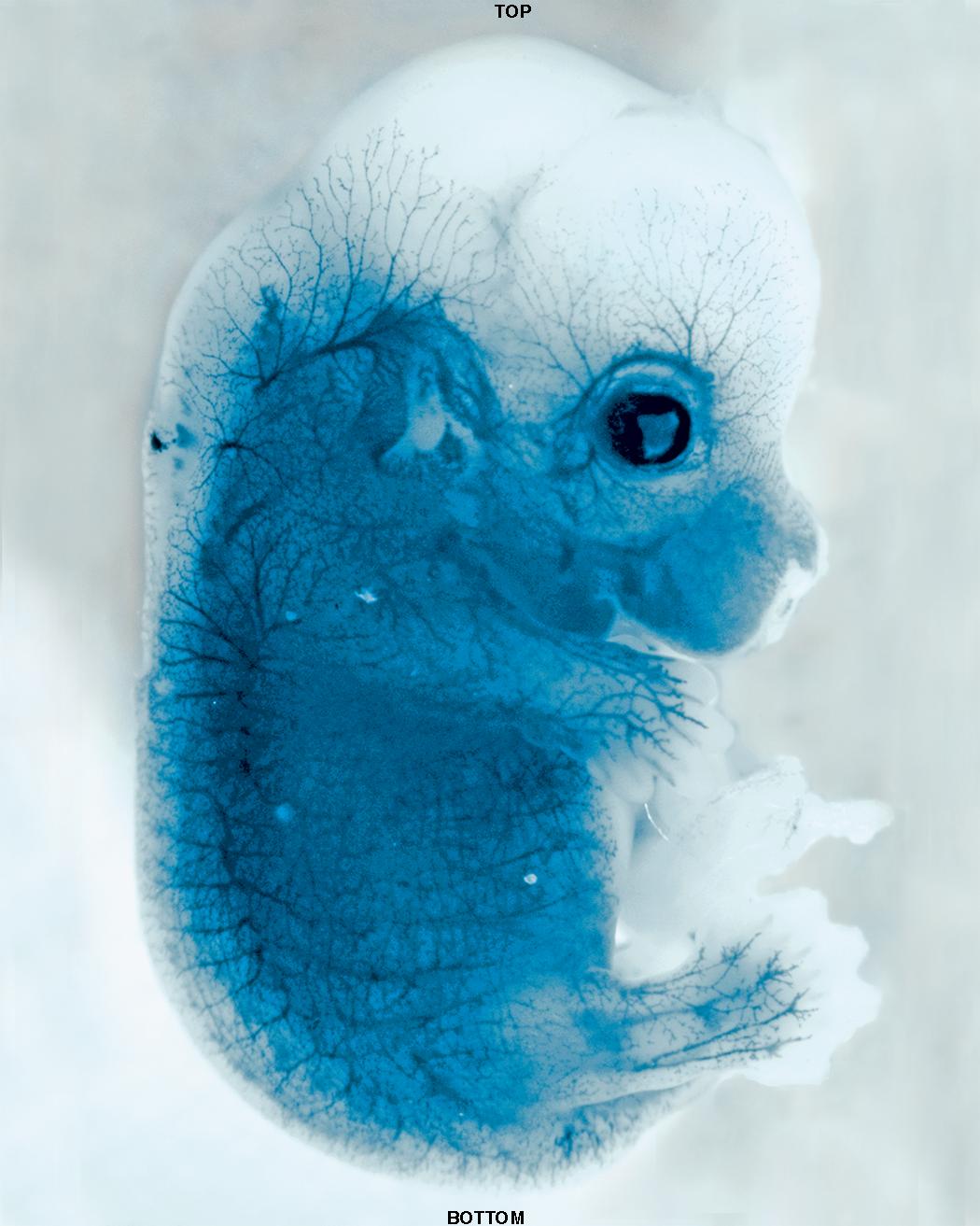 замороженные эмбрионы форум