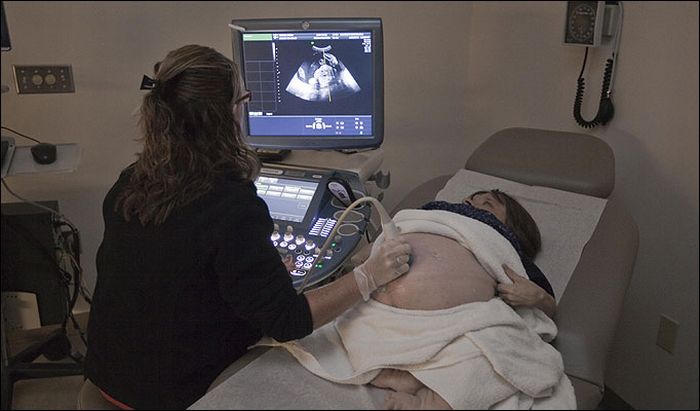 [small_mather_02.jpg]