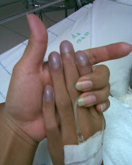 สีเล็บสว่างขึ้น