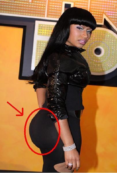 nicki minaj before surgery before and after. Nicki Minaj Booty Before and