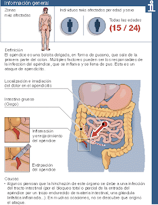 dolor de apendice y sintomas