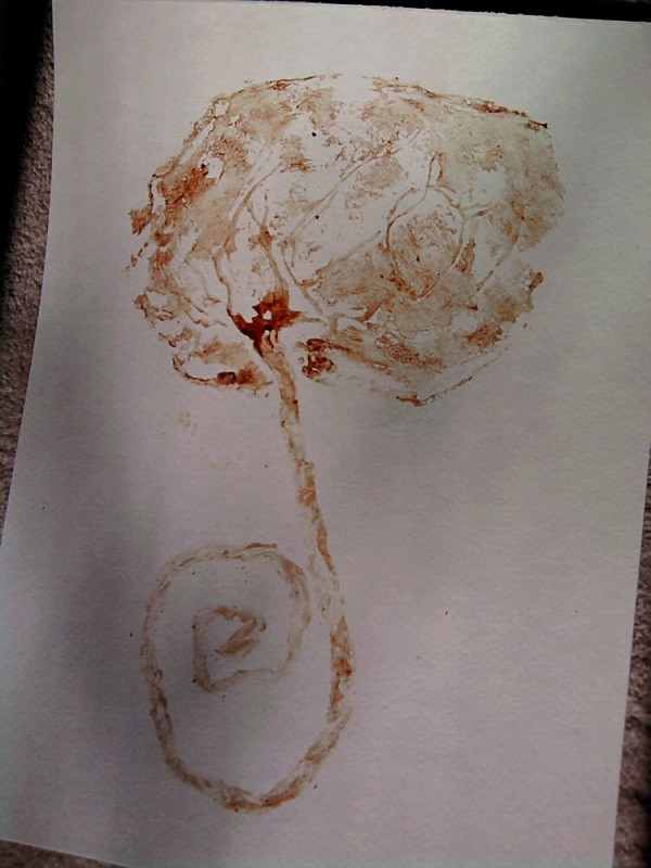 Placenta Print
