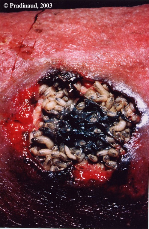 EdoUtin: Myasis ( Belatung dalam Tubuh manusia )