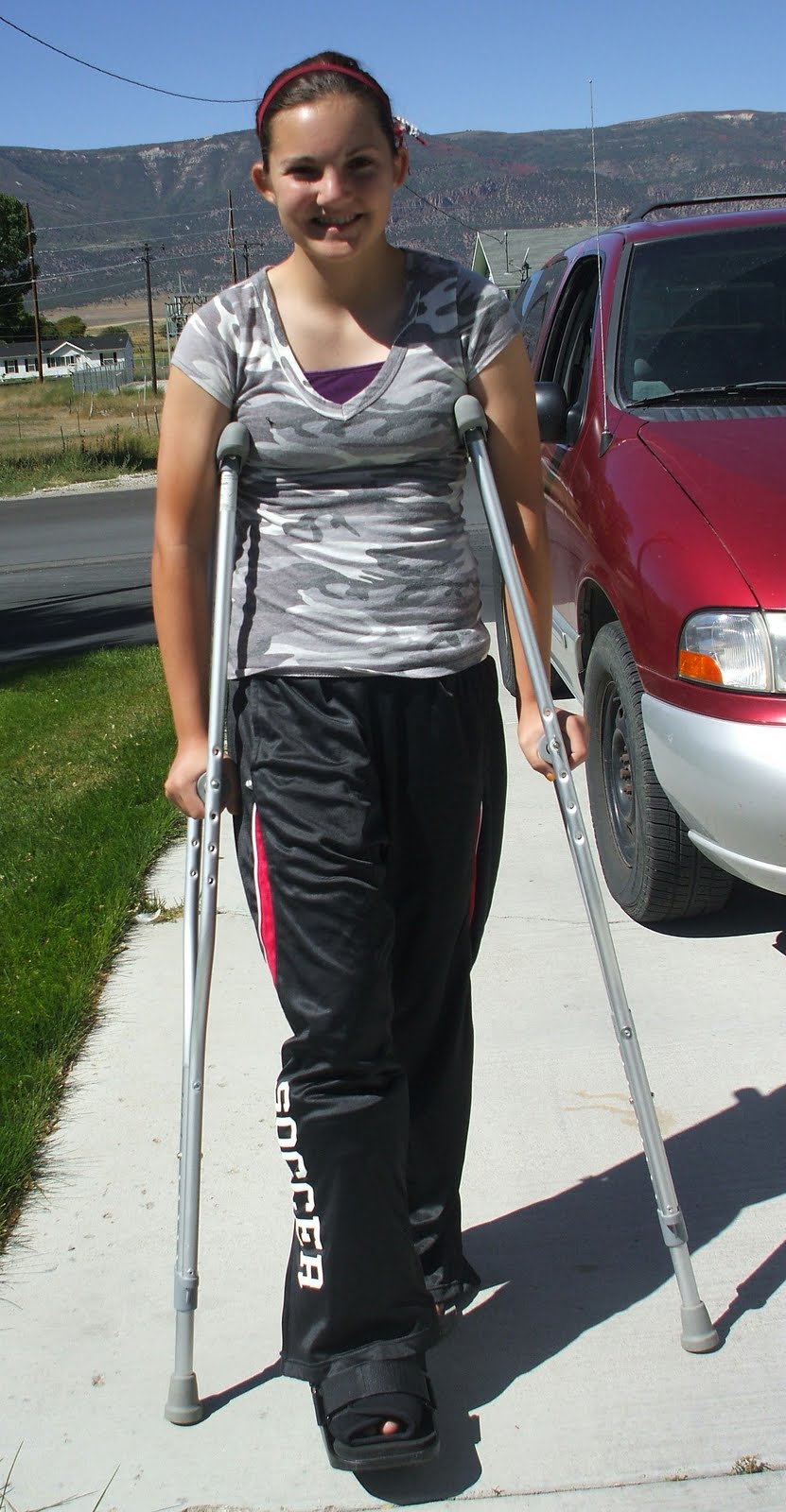 SKINNERTOPIA: Jasmine broke her ankle