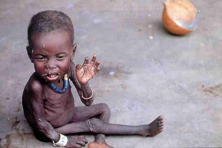 11 niños mueren de hambre cada minuto