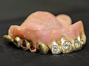 dentadura_de_oro.jpg