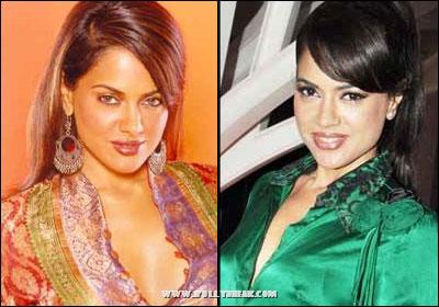 Bollywood Beauties Plastic Surgeries : Before / After