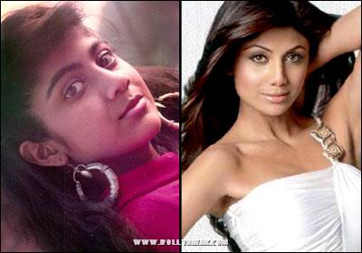 Bollywood Beauties Plastic Surgeries : Before / After
