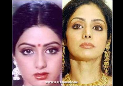 Bollywood Beauties Plastic Surgeries : Before / After