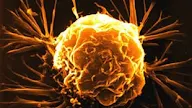 Proses Terjadinya Tumor atau Kanker