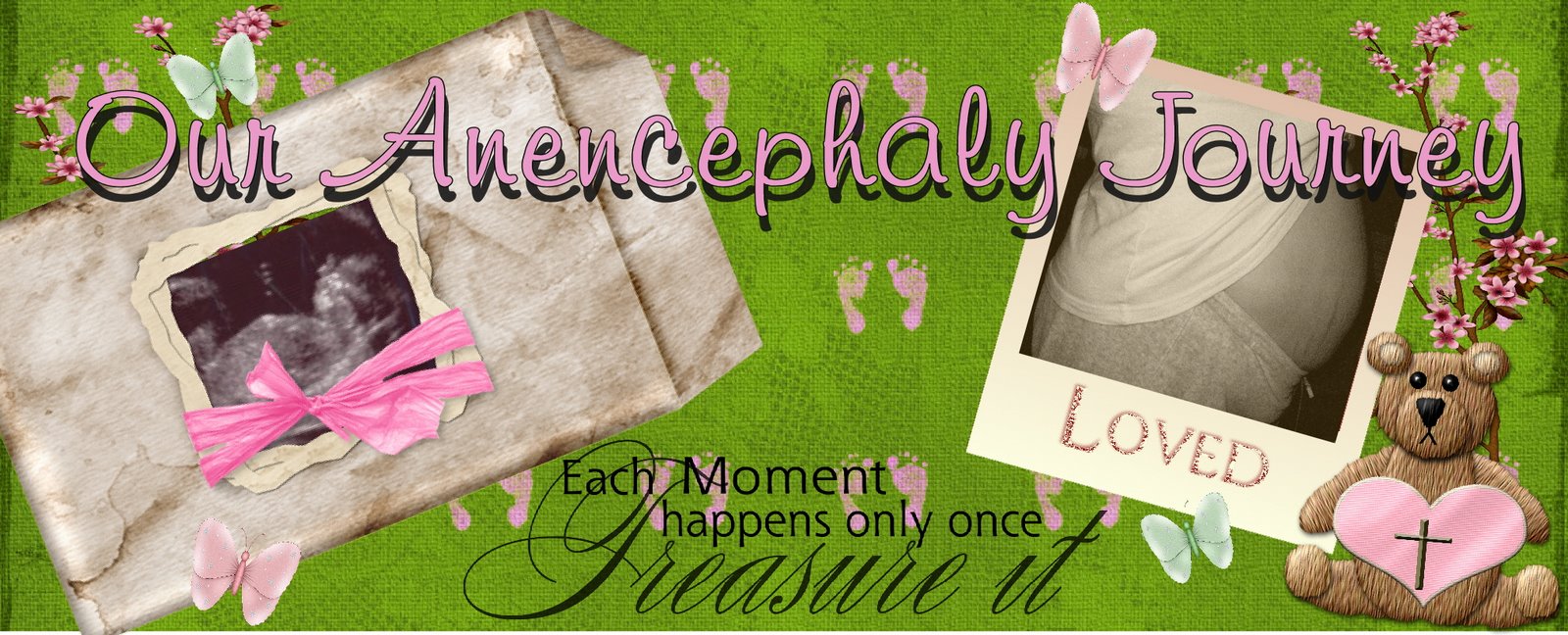 Our Anencephaly Journey