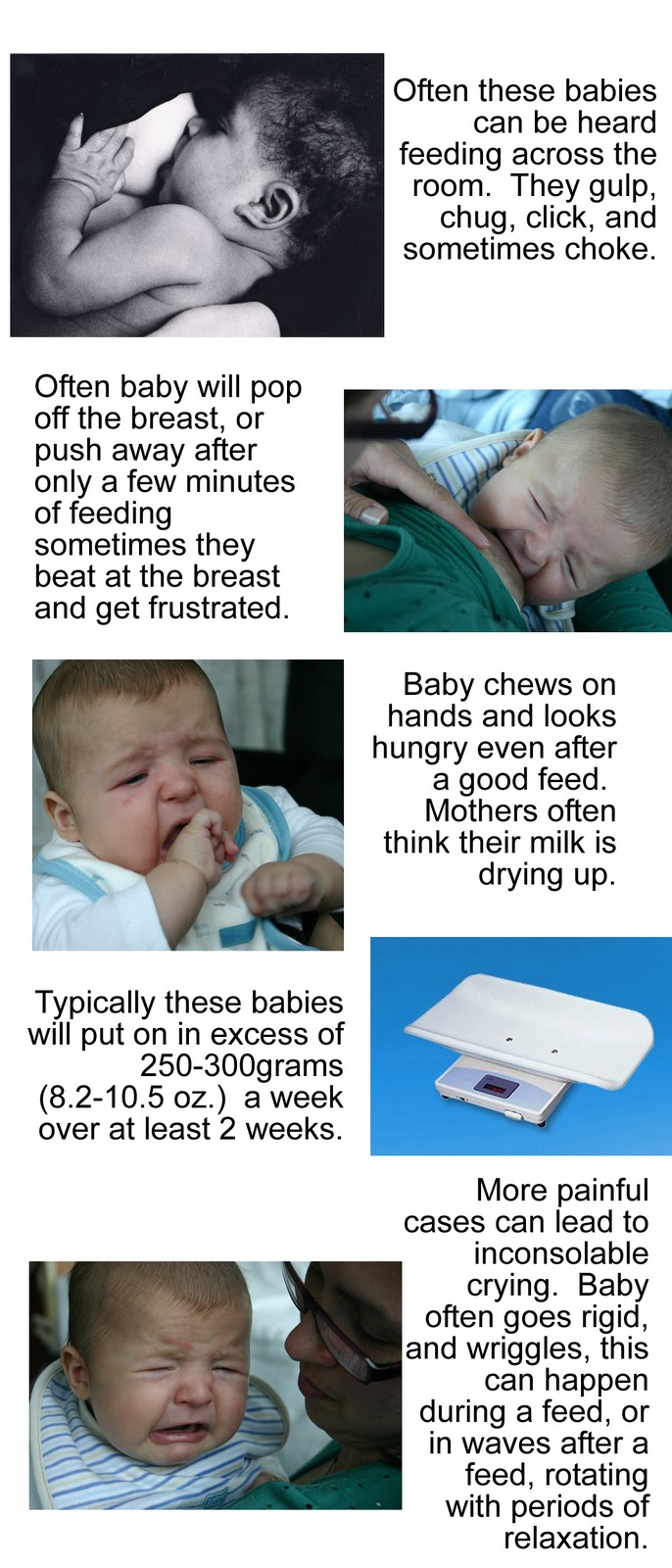 bubby a la mode Oversupply Reflux in a Breastfed Baby