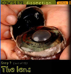 Cow's eye dissection (Exploratorium, San Francisco)