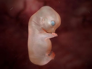 https://3.bp.blogspot.com/_PhG1mmuoluQ/RtD4ovzeAVI/AAAAAAAAAC0/ZMGt_16zBlY/s320/Dog+Embryo.jpg