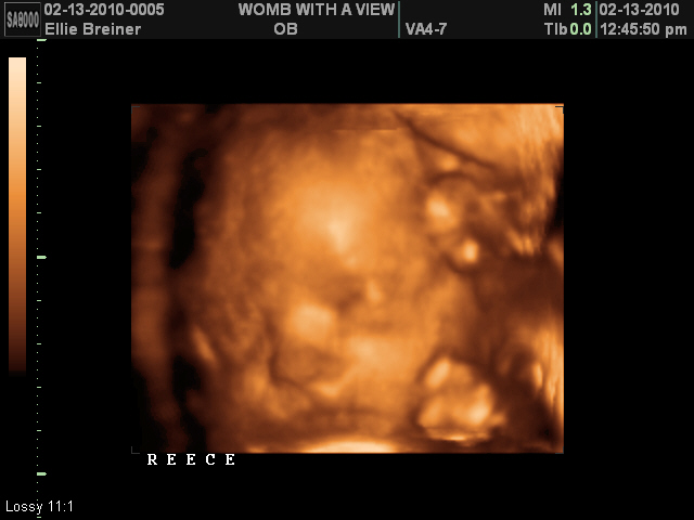 Life, Love, and Baby.: 27 weeks: 3d/4d ultrasound