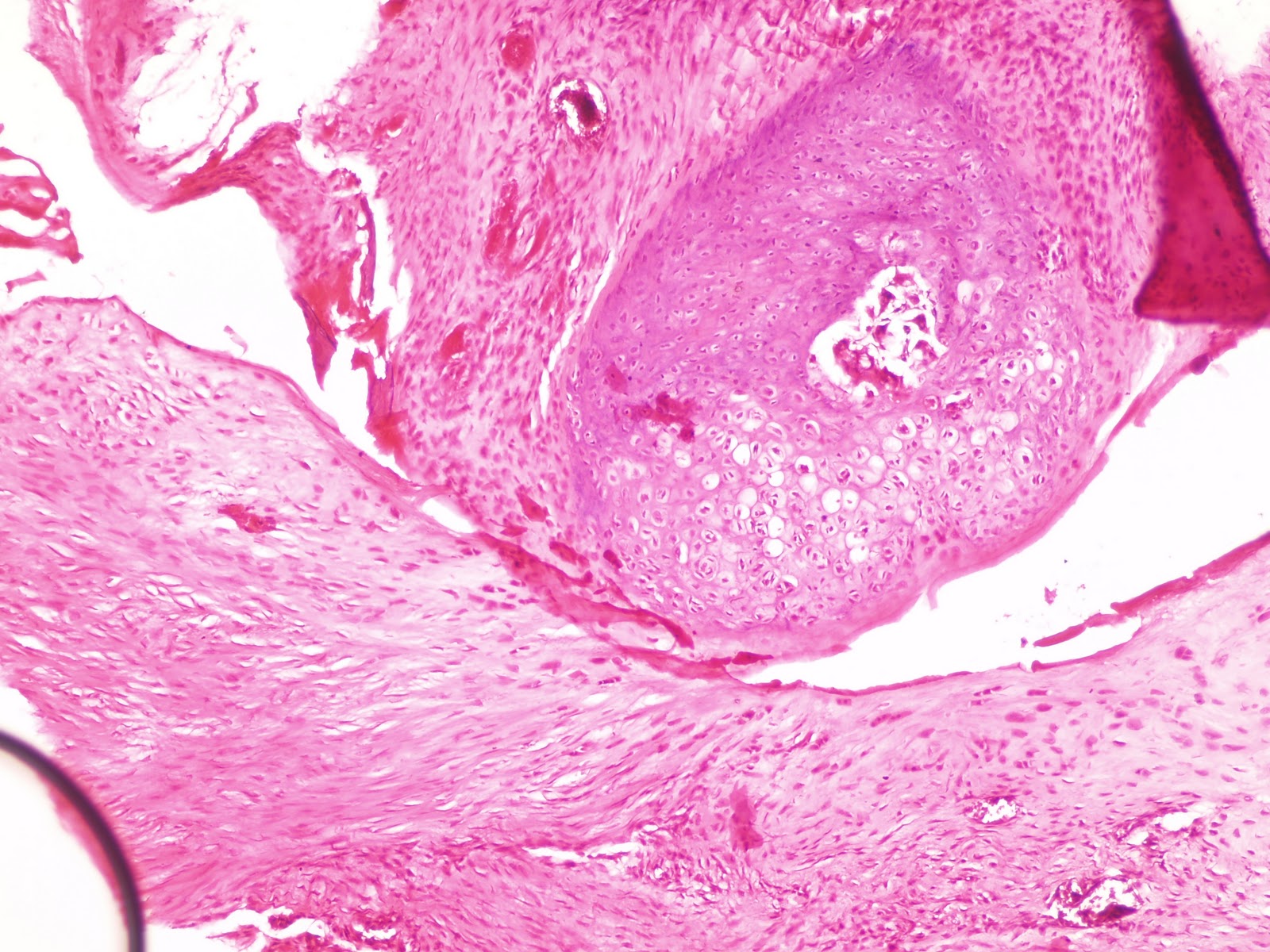 My experiments with Mice Histology of rat callus formation