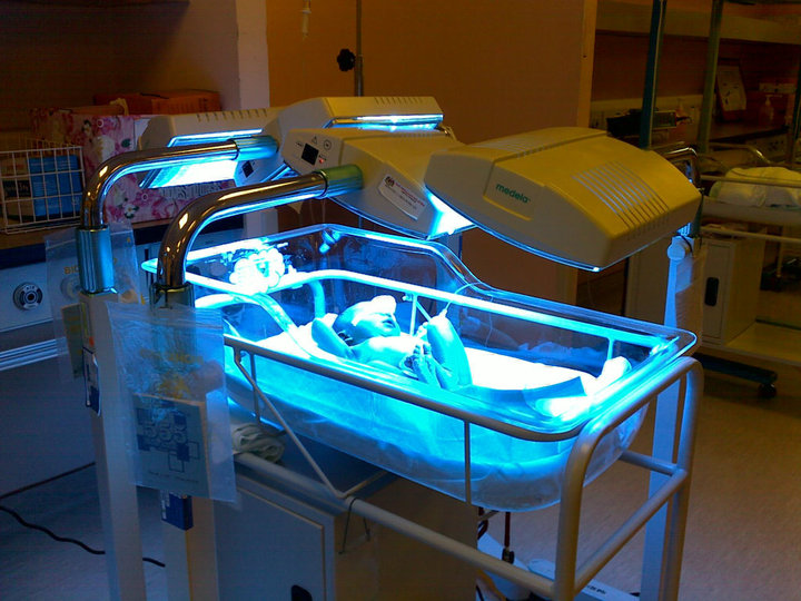 Passion for Healthy Children Jaundice babies