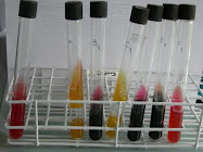 Pruebas Bioquimicas para GramNegativas