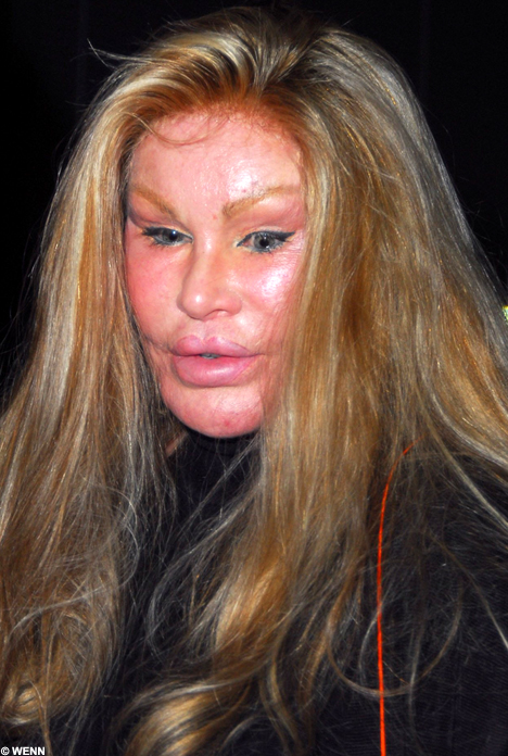 [Wildenstein1WENN_468x696.jpg]