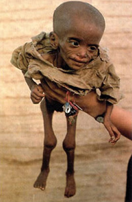 [fotos-desnutricion-en-africa[1].jpg]