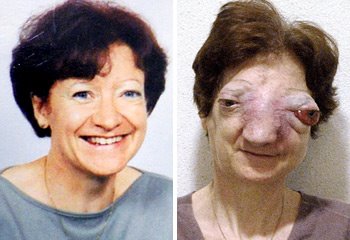 [euthanasia+woman.jpg]